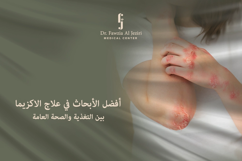 علاج الاكزيما