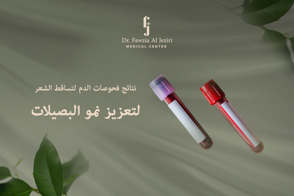 فحوصات الدم لتساقط الشعر