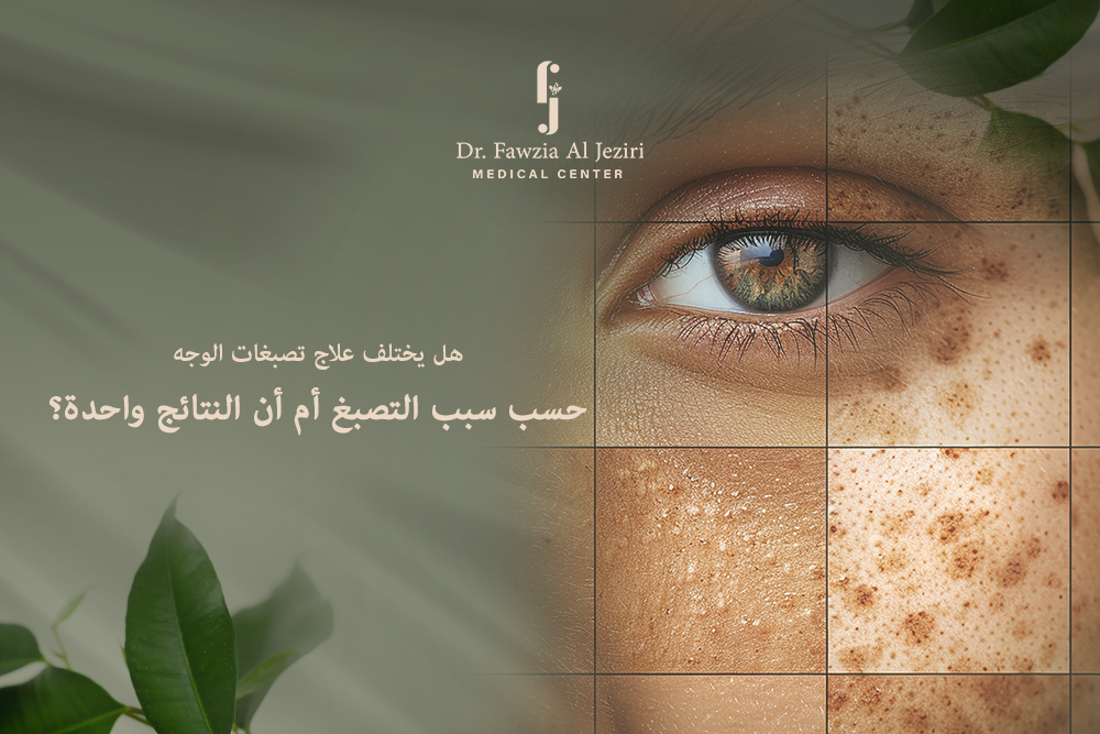 علاج تصبغات الوجه